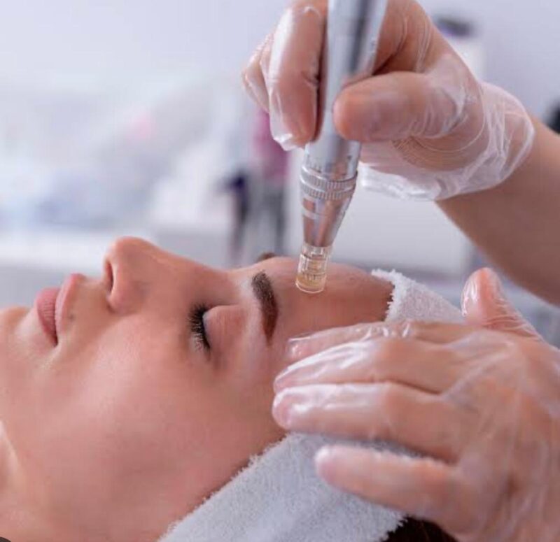 MTS (Microneedling Treatment System) + Manual Facial